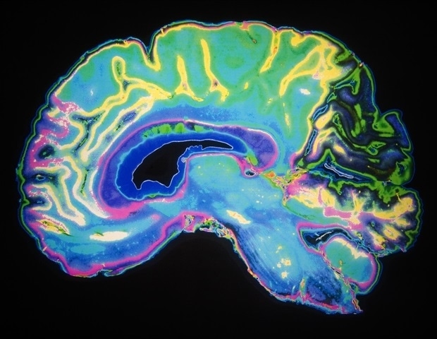 Unveiling Brain Sex Differences with AI Unveiling Brain Sex Differences with AI