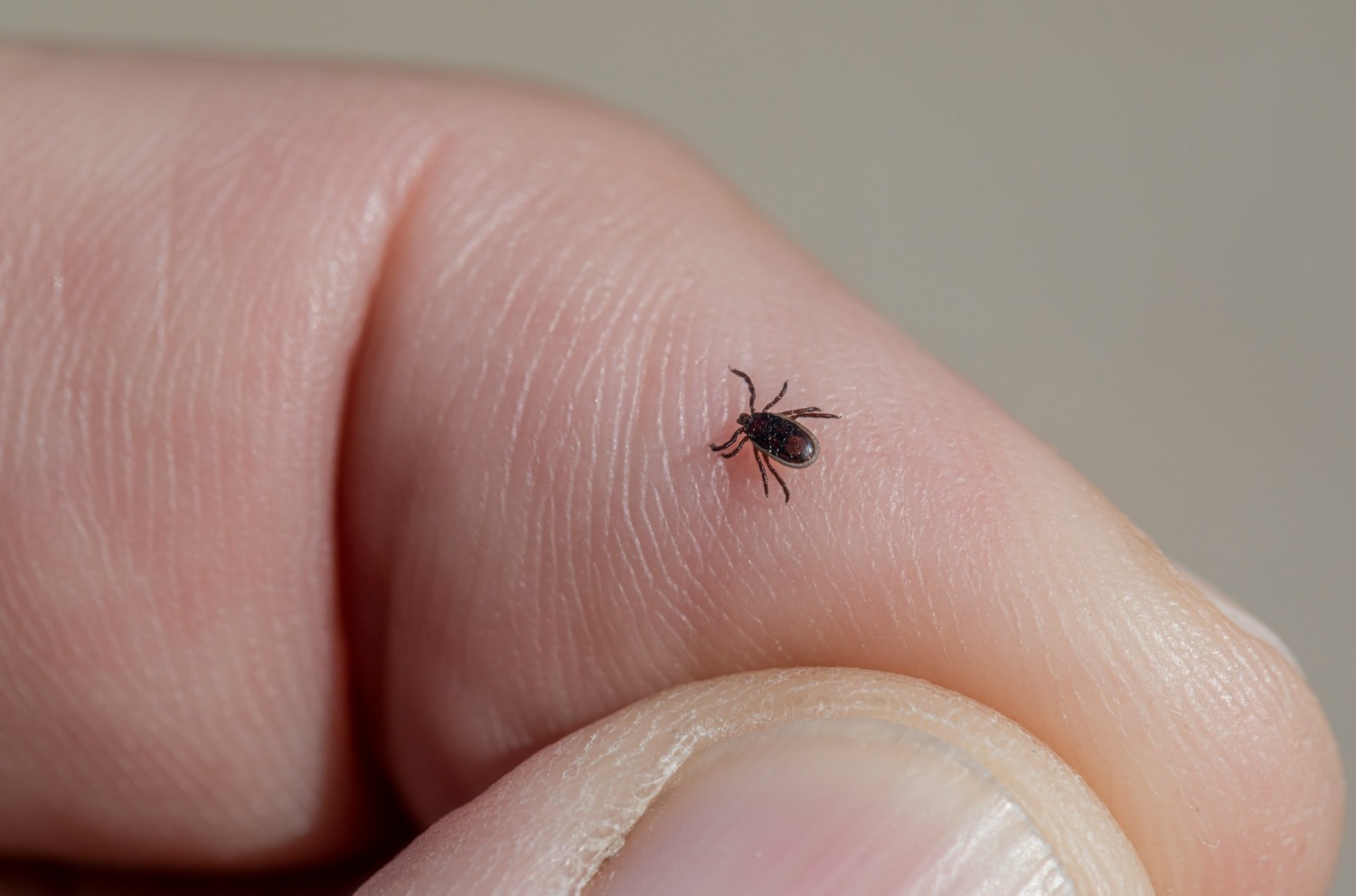 A Leap Forward in Lyme Disease Prevention: The Promising Tick-Killing Pill