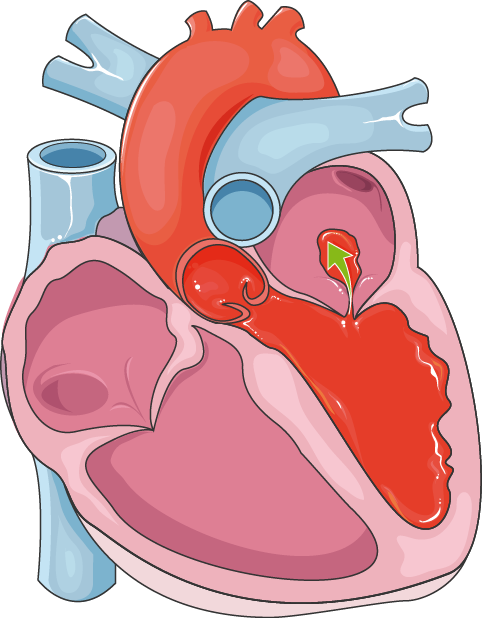 Intermittent Fasting: A Health Hazard? Unpacking the 91% Cardiovascular Risk Claim