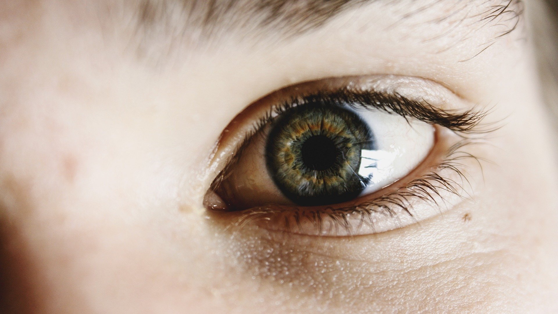 The Unseen Impact of Lazy Eye: How Childhood Amblyopia Influences Adult Health