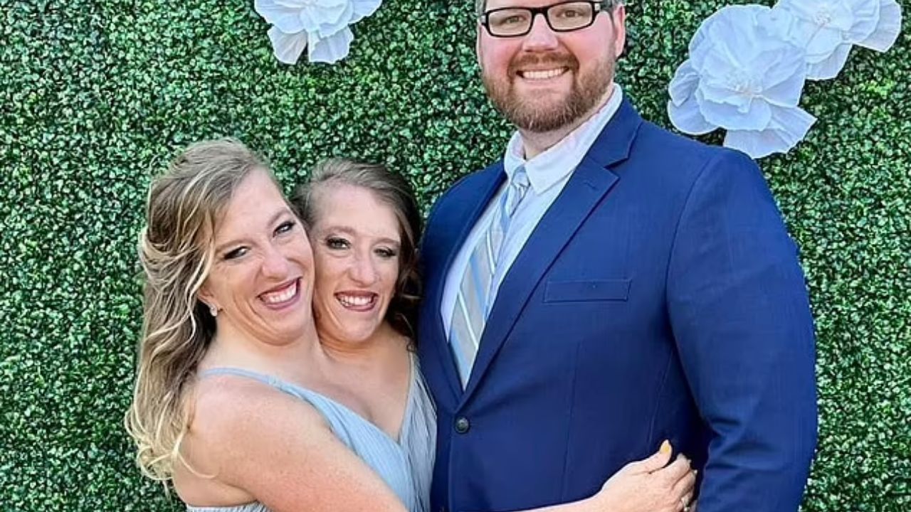 A Tale of Unconventional Love: Abby Hensel’s Heartwarming Wedding Journey
